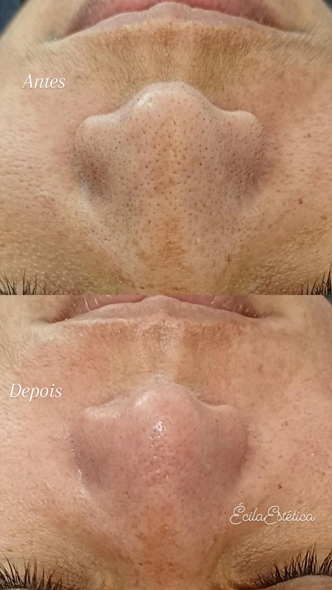 limpeza-de-pele-sobradinho-5