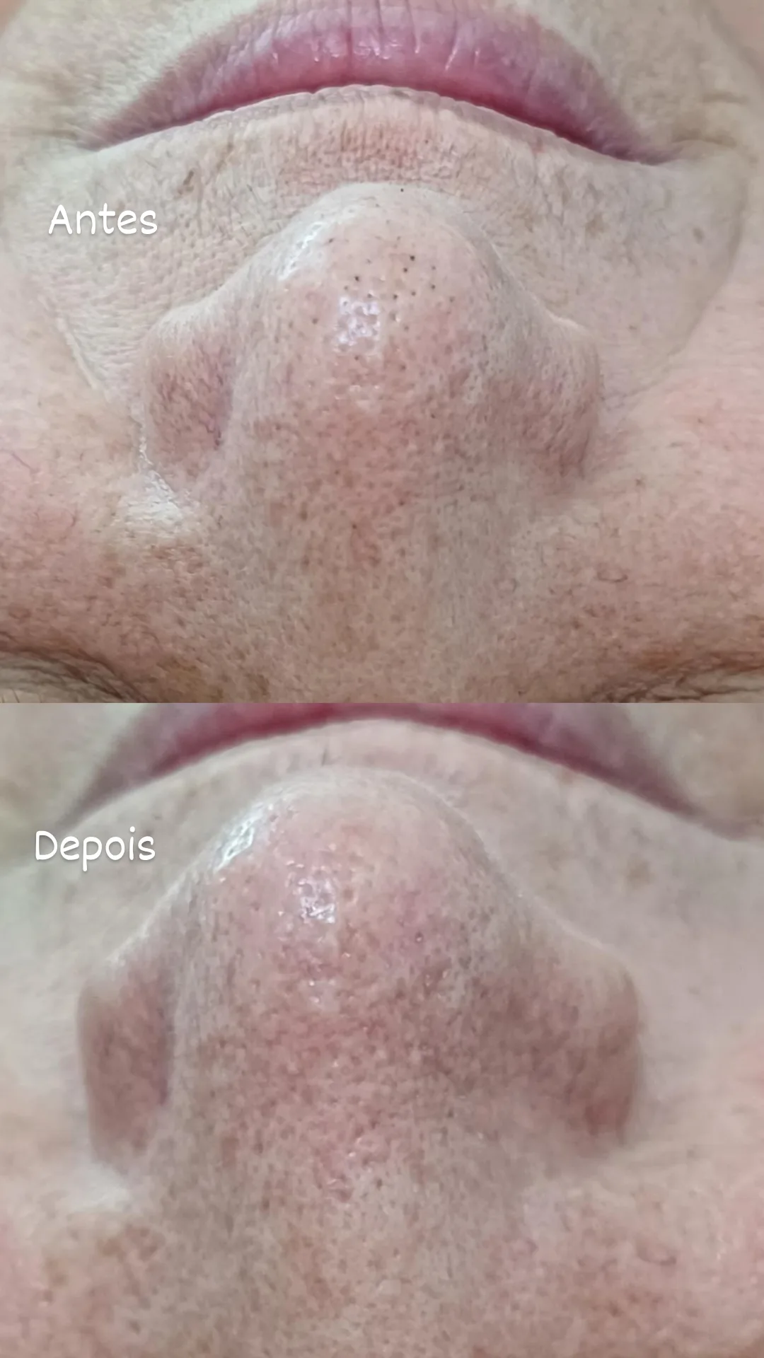 limpeza-de-pele-sobradinho-7