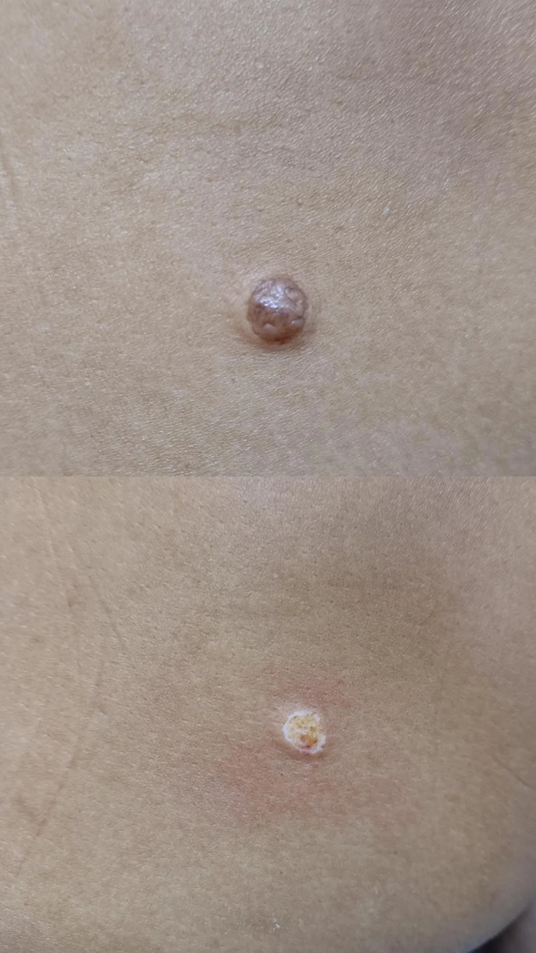 remocao-sinais-pintas-sobradinho-5