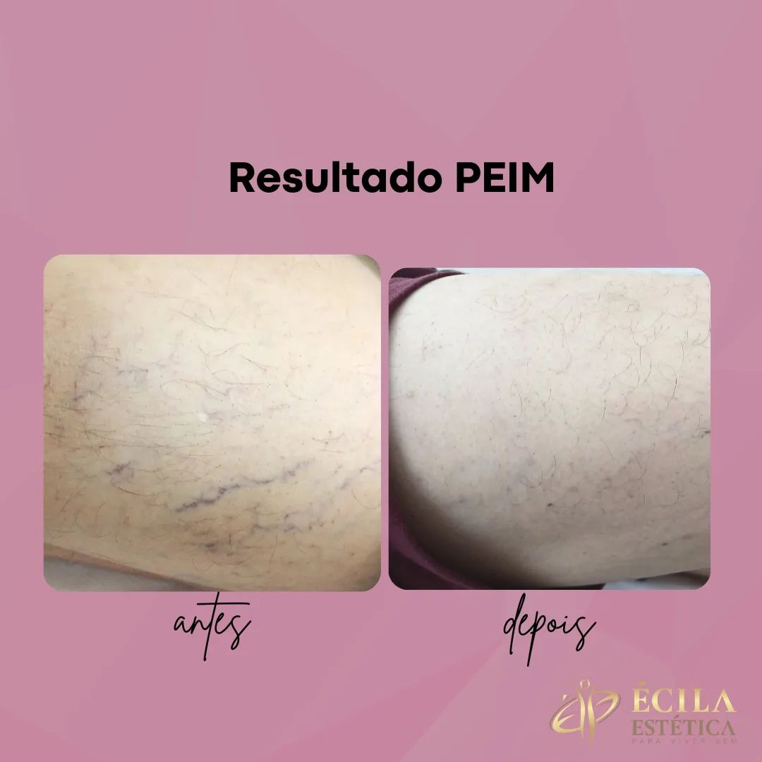 secagem-de-vasinhos-sobradinho-2