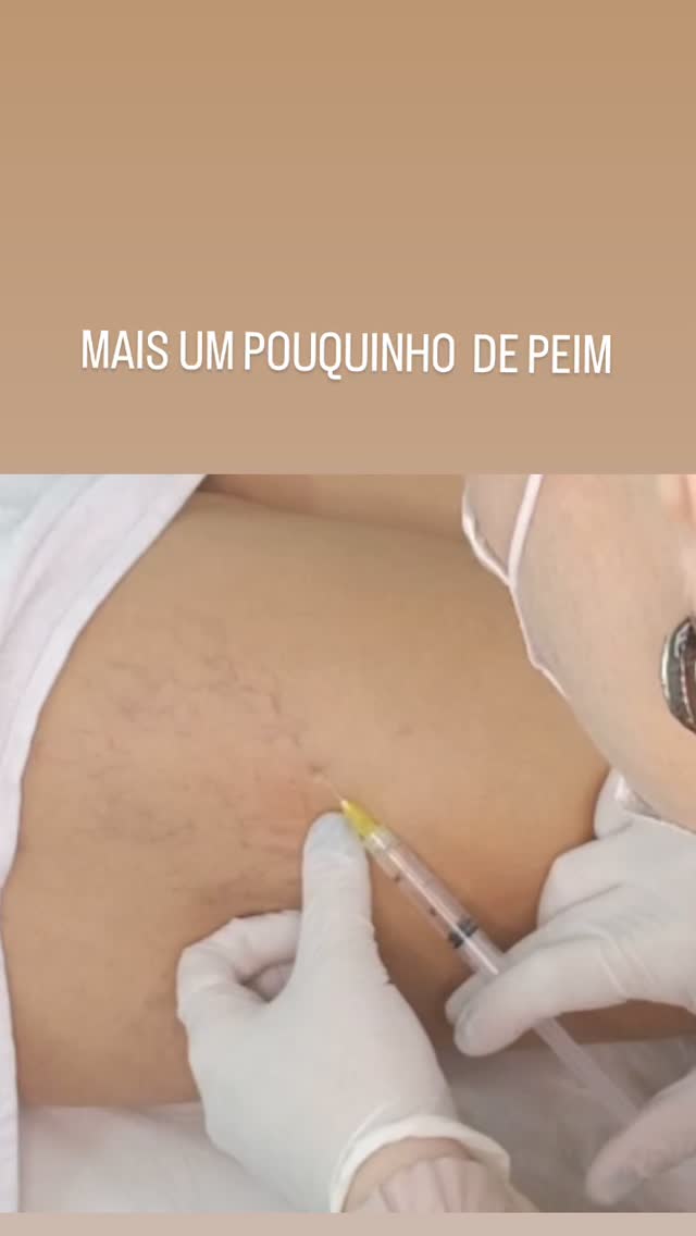 secagem-de-vasinhos-sobradinho-7