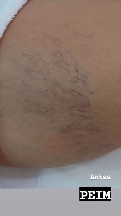 secagem-de-vasinhos-sobradinho-8