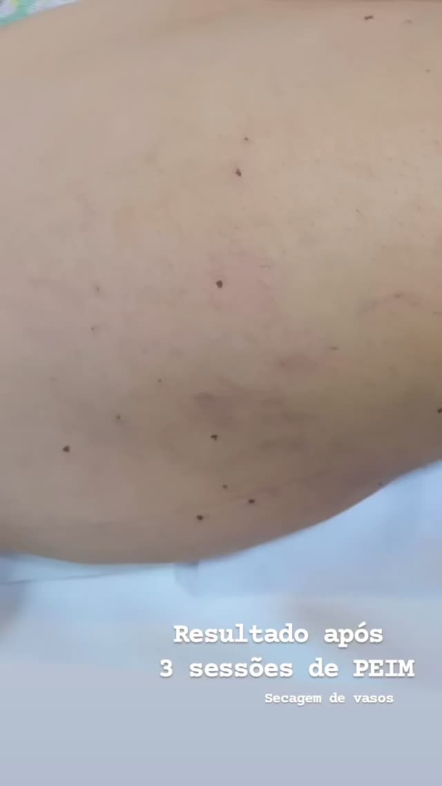 secagem-de-vasinhos-sobradinho-9